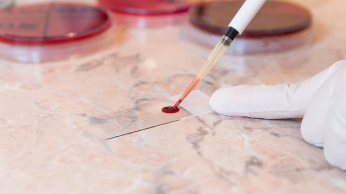 Grounding y trastornos de la anemia