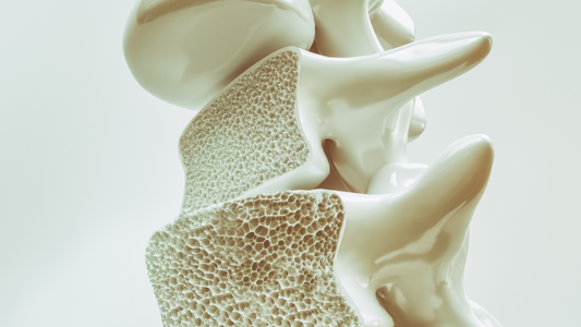 Earthing para la osteoporosis