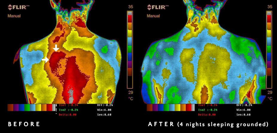 Termografía que muestra el antes y después de pasar 4 noches durmiendo con Earthing®. Se observa la fuerte disminución de inflamación en zona de la espalda. Fuente: https://www.earthinginstitute.net/wp-content/uploads/2019/02/thermographycasehistories2004